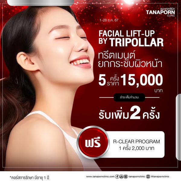 FACIAL LIFT-UP BY TRIPOLLAR