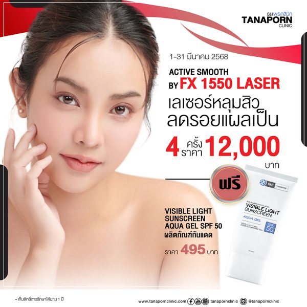 ACTIVE SMOOTH BY FX1550 LASER