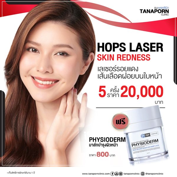 HOPS LASER SKIN REDNESS