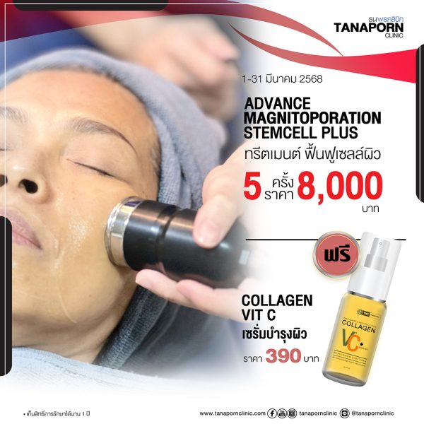 ADVANCE MAGNITOPORATION STEMCELL PLUS