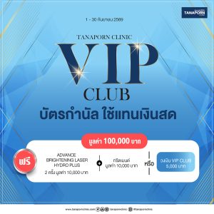 VIP CLUB 100000