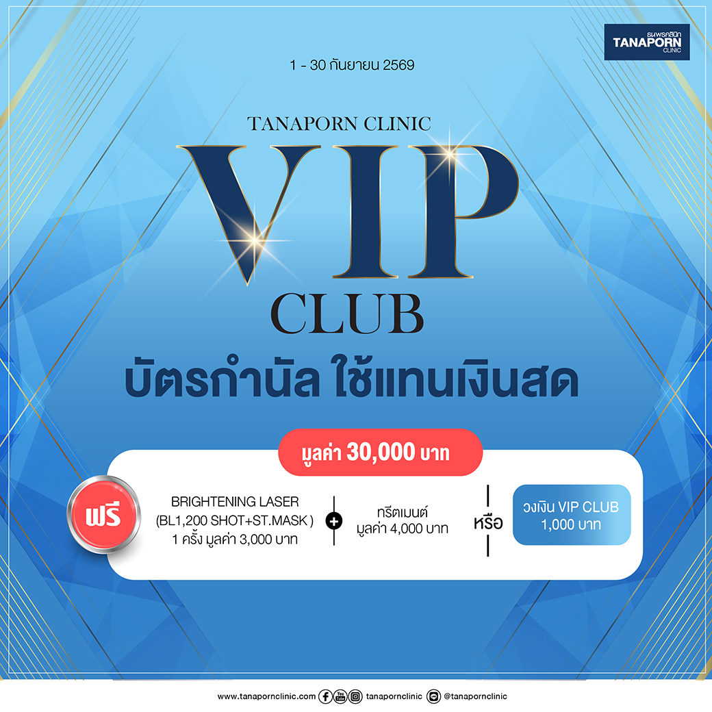 VIP CLUB 30000