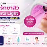 ฉายแสงรักษาสิว