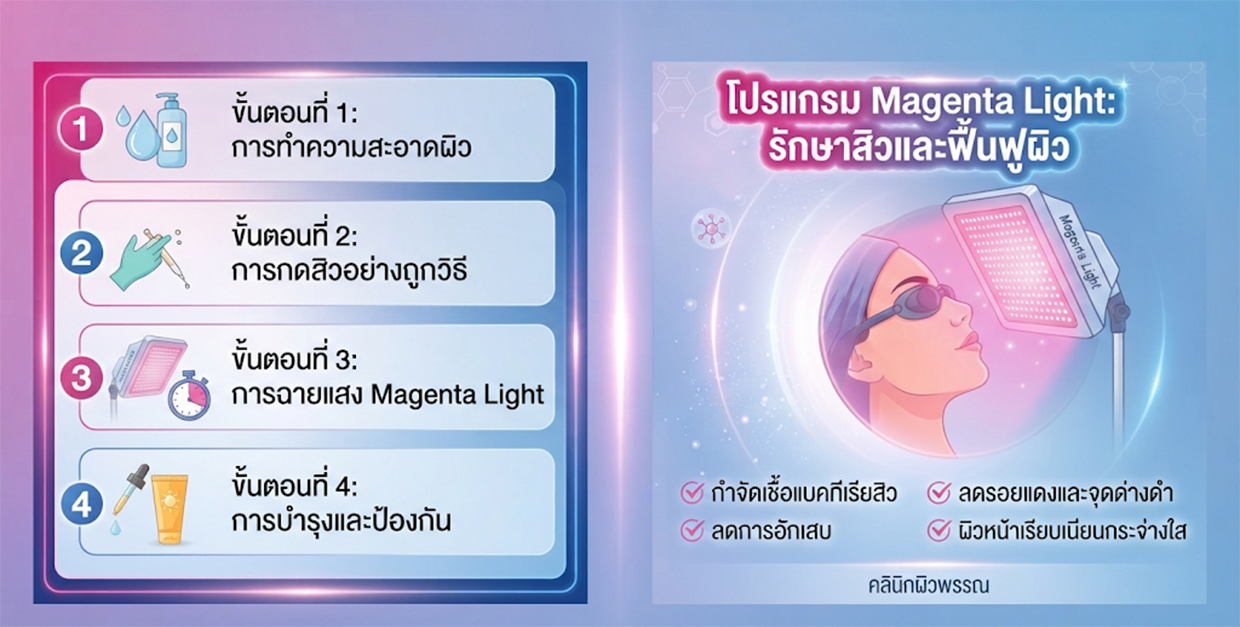 โปรแกรม Magenta Light